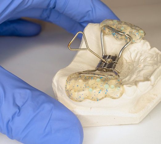 a person holding a model of a palatal expander