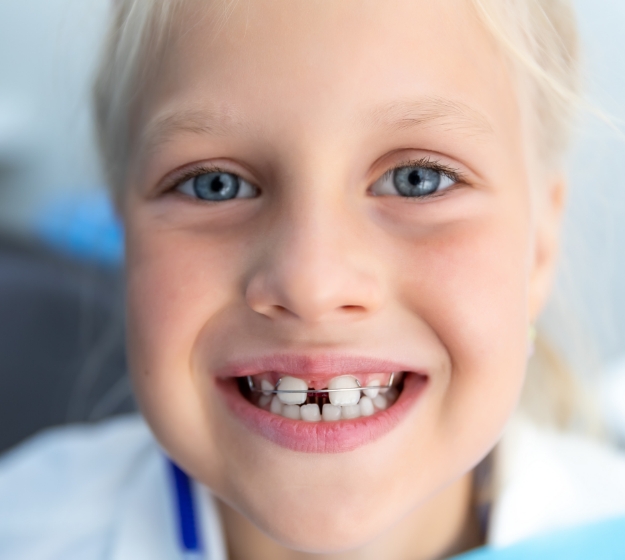 Child with a missing upper tooth wearing braces