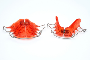 a close-up of a palatal expander 