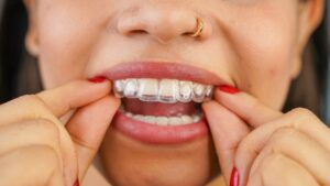 Woman putting on her retainer